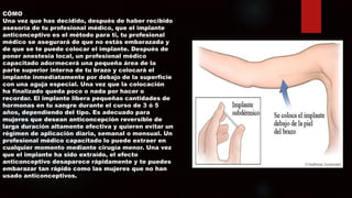 CÓMO
Una vez que has decidido, después de haber recibido
asesoría de tu profesional médico, que el implante
anticonceptivo es el método para ti, tu profesional
médico se asegurará de que no estás embarazada y
de que se te puede colocar el implante. Después de
poner anestesia local, un profesional médico
capacitado adormecerá una pequeña área de la
parte superior interna de tu brazo y colocará el
implante inmediatamente por debajo de la superficie
con una aguja especial. Una vez que la colocación
ha finalizado queda poco o nada por hacer o
recordar. El implante libera pequeñas cantidades de
hormonas en tu sangre durante el curso de 3 ó 5
años, dependiendo del tipo. Es adecuado para
mujeres que desean anticoncepción reversible de
larga duración altamente efectiva y quieren evitar un
régimen de aplicación diaria, semanal o mensual. Un
profesional médico capacitado lo puede extraer en
cualquier momento mediante cirugía menor. Una vez
que el implante ha sido extraído, el efecto
anticonceptivo desaparece rápidamente y te puedes
embarazar tan rápido como las mujeres que no han
usado anticonceptivos.
 