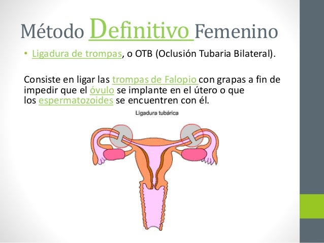 Navegación de entradas