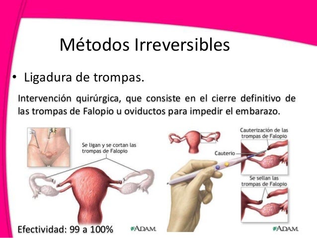 Cuadro comparativo de los m todos anticonceptivos