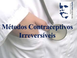 Métodos Contraceptivos Irreversíveis 