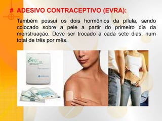 # ADESIVO CONTRACEPTIVO (EVRA):
Também possui os dois hormônios da pílula, sendo
colocado sobre a pele a partir do primeiro dia da
menstruação. Deve ser trocado a cada sete dias, num
total de três por mês.
 