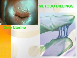 MÉTODO BILLINGS
Colo Uterino
 