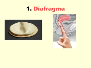 1.  Diafragma 