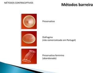  Dismenorreia (dor menstrual)MÉTODOS CONTRACEPTIVOSTipos de pílulaEstrogénio ProgestagénioCombinadaEstrogénio e ProgestagénioMonofásica ou Trifásica