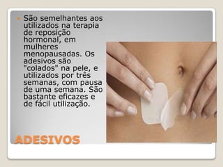 ADESIVOSSão semelhantes aos utilizados na terapia de reposição hormonal, em mulheres menopausadas. Os adesivos são "colados" na pele, e utilizados por três semanas, com pausa de uma semana. São bastante eficazes e de fácil utilização.