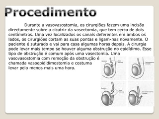 Durante a vasovasostomia, os cirurgiões fazem uma incisão
directamente sobre a cicatriz da vasectomia, que tem cerca de dois
centímetros. Uma vez localizados os canais deferentes em ambos os
lados, os cirurgiões cortam as suas pontas e ligam-nas novamente. O
paciente é suturado e vai para casa algumas horas depois. A cirurgia
pode levar mais tempo se houver alguma obstrução no epidídimo. Esse
tipo de obstrução é comum após uma vasectomia. Uma
vasovasostomia com remoção da obstrução é
chamada vasoepididimostomia e costuma
levar pelo menos mais uma hora.
 