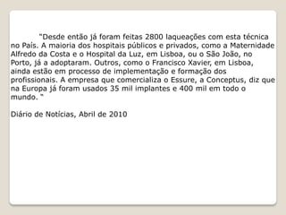 “Desde então já foram feitas 2800 laqueações com esta técnica
no País. A maioria dos hospitais públicos e privados, como a Maternidade
Alfredo da Costa e o Hospital da Luz, em Lisboa, ou o São João, no
Porto, já a adoptaram. Outros, como o Francisco Xavier, em Lisboa,
ainda estão em processo de implementação e formação dos
profissionais. A empresa que comercializa o Essure, a Conceptus, diz que
na Europa já foram usados 35 mil implantes e 400 mil em todo o
mundo. “

Diário de Notícias, Abril de 2010
 