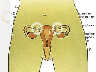 Laqueadura ou Ligação de Trompas
   É uma intervenção cirúrgica, onde as trompas da mulher
    são amarradas ou cortadas, evitando com que o óvulo e os
    espermatozóides se encontrem.
   É um método definitivo, ou seja, depois que a laqueadura é
    feita, é impossível engravidar novamente.
   Deve ser um método utilizado com muita certeza do que se
    está fazendo. Muitas mulheres se arrependem anos após a
    realização da esterilização, mesmo que tenham dito ter
    certeza do que queriam fazer.
   Só é indicado para mulheres maiores que 25 anos que já
    tenham pelo menos 2 filhos.
 