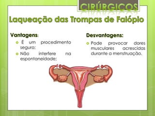 :



É um procedimento
seguro;
Não
interfere
na
espontaneidade;



Pode provocar dores
musculares
acrescidas
durante a menstruação.

 