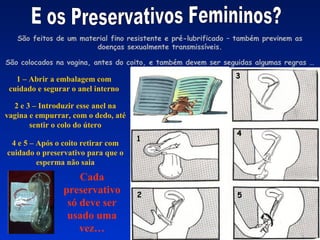 São feitos de um material fino resistente e pré-lubrificado – também previnem as
doenças sexualmente transmissíveis.
São colocados na vagina, antes do coito, e também devem ser seguidas algumas regras …
1 – Abrir a embalagem com
cuidado e segurar o anel interno
2 e 3 – Introduzir esse anel na
vagina e empurrar, com o dedo, até
sentir o colo do útero
4 e 5 – Após o coito retirar com
cuidado o preservativo para que o
esperma não saia
Cada
preservativo
só deve ser
usado uma
vez…
 