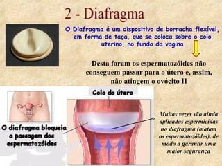 O Diafragma é um dispositivo de borracha flexível,
em forma de taça, que se coloca sobre o colo
uterino, no fundo da vagina
Desta foram os espermatozóides não
conseguem passar para o útero e, assim,
não atingem o ovócito II
Muitas vezes são ainda
aplicados espermicidas
no diafragma (matam
os espermatozóides), de
modo a garantir uma
maior segurança
 