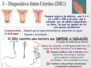 Pequeno objecto de plástico, com 3 a 4
cm e 200 a 300 g de peso, que é
colocado, por um médico especialista,
no útero, do qual sai apenas um fio
com poucos centímetros
O preservativo … Impede que os espermatozóides se depositem na vagina
O diafragma … Impede a fecundação …
O DIU constitui uma barreira que IMPEDE A NIDAÇÃO
(fixação do embrião ao útero)
Depois de colocado, o diafragma pode ficar no
corpo da mulher durante 2 a 4 anos mas…
Algumas mulheres não o toleram: dores
abdominais, hemorragias, infecções
graves (algumas conduzem até à
esterilidade) – não aconselhável a jovens
 Continua a não proteger das doenças
sexualmente transmissíveis
 