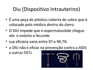 Diu (Dispositivo Intrauterino)
• É uma peça de plástico coberta de cobre que é
colocado pelo médico dentro do útero.
• O DIU Impede que o espermatozóide chegue
até o ovócito e fecunde
• sua eficácia varia entre 97 e 99,7%
• o DIU não é eficaz na prevenção contra a AIDS
e outras DSTs
 