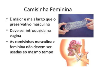 Camisinha Feminina
• È maior e mais largo que o
preservativo masculino
• Deve ser introduzida na
vagina
• As camisinhas masculina e
feminina não devem ser
usadas ao mesmo tempo
 