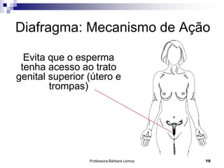 Professora Bárbara Lemos 16
Diafragma: Mecanismo de Ação
Evita que o esperma
tenha acesso ao trato
genital superior (útero e
trompas)
 