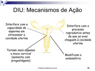 Professora Bárbara Lemos 18
DIU: Mecanismos de Ação
Interfere com a
capacidade do
esperma em
atravessar a
cavidade uterina
Tornam mais espesso
o muco cervical
(somente com
progestágeno)
Modificam o
endométrio
Interfere com o
processo
reprodutivo antes
de que os ovos
cheguem à cavidade
uterina
 