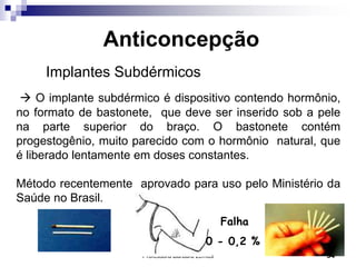 Professora Bárbara Lemos 34
Anticoncepção
Implantes Subdérmicos
 O implante subdérmico é dispositivo contendo hormônio,
no formato de bastonete, que deve ser inserido sob a pele
na parte superior do braço. O bastonete contém
progestogênio, muito parecido com o hormônio natural, que
é liberado lentamente em doses constantes.
Método recentemente aprovado para uso pelo Ministério da
Saúde no Brasil.
Falha
0 - 0,2 %
 