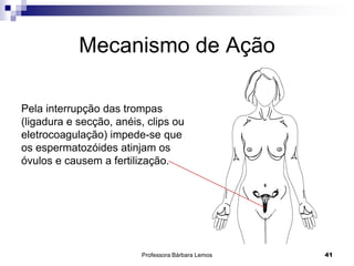 Professora Bárbara Lemos 41
Mecanismo de Ação
Pela interrupção das trompas
(ligadura e secção, anéis, clips ou
eletrocoagulação) impede-se que
os espermatozóides atinjam os
óvulos e causem a fertilização.
 
