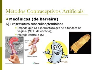 Métodos Contraceptivos Artificiais 
 Mecânicos (de barreira) 
A) Preservativo masculino/feminino: 
 Impede que os espermatozóides se difundam na 
vagina. (90% de eficácia); 
 Protege contra a IST. 
 
