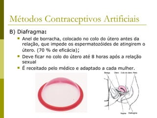 Métodos Contraceptivos Artificiais 
B) Diafragma: 
 Anel de borracha, colocado no colo do útero antes da 
relação, que impede os espermatozóides de atingirem o 
útero. (70 % de eficácia); 
 Deve ficar no colo do útero até 8 horas após a relação 
sexual 
 É receitado pelo médico e adaptado a cada mulher. 
 