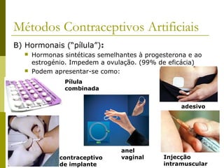 Métodos Contraceptivos Artificiais 
B) Hormonais (“pílula”): 
 Hormonas sintéticas semelhantes à progesterona e ao 
estrogénio. Impedem a ovulação. (99% de eficácia) 
 Podem apresentar-se como: 
Pílula 
combinada 
contraceptivo 
de implante 
adesivo 
Injecção 
intramuscular 
anel 
vaginal 
 
