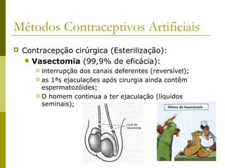 Métodos Contraceptivos Artificiais 
 Contracepção cirúrgica (Esterilização): 
 Vasectomia (99,9% de eficácia): 
 interrupção dos canais deferentes (reversível); 
 as 1ªs ejaculações após cirurgia ainda contêm 
espermatozóides; 
 O homem continua a ter ejaculação (líquidos 
seminais); 
 