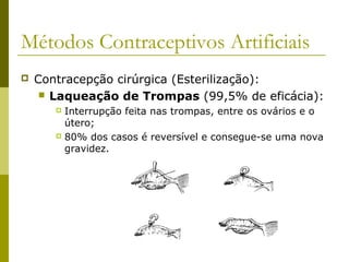 Métodos Contraceptivos Artificiais 
 Contracepção cirúrgica (Esterilização): 
 Laqueação de Trompas (99,5% de eficácia): 
 Interrupção feita nas trompas, entre os ovários e o 
útero; 
 80% dos casos é reversível e consegue-se uma nova 
gravidez. 
 