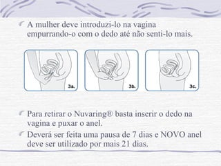 A mulher deve introduzi-lo na vagina
empurrando-o com o dedo até não senti-lo mais.
Para retirar o Nuvaring® basta inserir o dedo na
vagina e puxar o anel.
Deverá ser feita uma pausa de 7 dias e NOVO anel
deve ser utilizado por mais 21 dias.
 