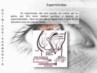 Q
U
Í
M
I
C
O
S
/
H
O
R
M
O
N
A
I
S
Espermicidas
Os espermicidas são uma solução em creme, gel ou
geleia, que têm como objetivo paralisar e destruir os
espermatozóides. Deve ser aplicado na vagina (com a ajuda de um
aplicador) antes de cada ato sexual.
 