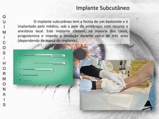 Q
U
Í
M
I
C
O
S
/
H
O
R
M
O
N
A
I
S
Implante Subcutâneo
O implante subcutâneo tem a forma de um bastonete e é
implantado pelo médico, sob a pele do antebraço, com recurso a
anestesia local. Este implante contem, na maioria dos casos,
progesterona e impede a ovulação durante cerca de três anos
(dependendo da marca do implante).
 