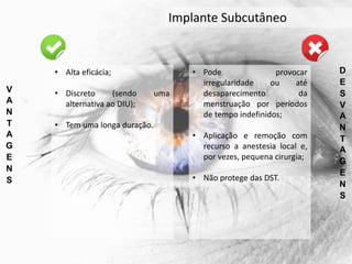 V
A
N
T
A
G
E
N
S
D
E
S
V
A
N
T
A
G
E
N
S
• Alta eficácia;
• Discreto (sendo uma
alternativa ao DIU);
• Tem uma longa duração.
• Pode provocar
irregularidade ou até
desaparecimento da
menstruação por períodos
de tempo indefinidos;
• Aplicação e remoção com
recurso a anestesia local e,
por vezes, pequena cirurgia;
• Não protege das DST.
Implante Subcutâneo
 