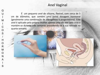 Q
U
Í
M
I
C
O
S
/
H
O
R
M
O
N
A
I
S
Anel Vaginal
É um pequeno anel de silicone, flexível, com cerca de 5
cm de diâmetro, que contém uma baixa dosagem hormonal
(geralmente uma combinação de estrogénios e progesterona). Este
anel é aplicado pela própria mulher apenas uma vez em cada ciclo e
mantém-se durante três semanas procedendo-se à sua retirada na
quarta semana.
 