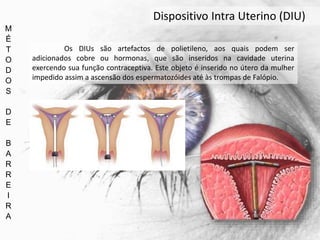 M
É
T
O
D
O
S
D
E
B
A
R
R
E
I
R
A
Dispositivo Intra Uterino (DIU)
Os DIUs são artefactos de polietileno, aos quais podem ser
adicionados cobre ou hormonas, que são inseridos na cavidade uterina
exercendo sua função contraceptiva. Este objeto é inserido no útero da mulher
impedido assim a ascensão dos espermatozóides até às trompas de Falópio.
 