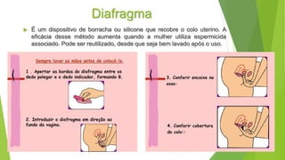 Diafragma
 É um dispositivo de borracha ou silicone que recobre o colo uterino. A
eficácia desse método aumenta quando a mulher utiliza espermicida
associado. Pode ser reutilizado, desde que seja bem lavado após o uso.
 