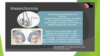 Métodos contraceptivos