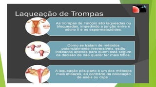 Métodos contraceptivos