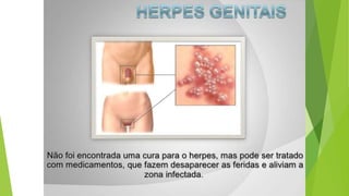 Métodos contraceptivos