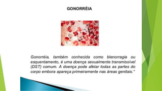 Métodos contraceptivos