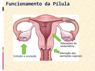 Funcionamento da Pílula
Inibição a ovulação
Alteração das
secreções vaginais.
Alterações do
endométrio
Ovário
Trompas de
Falópio
ÚTERO
Ovário
 