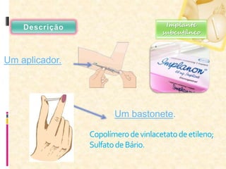 Copolímerodevinlacetatodeetileno;
SulfatodeBário.
Um aplicador.
Um bastonete.
Implante
subcutâneo
 