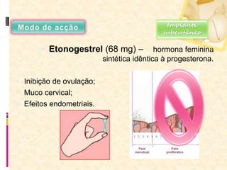  Etonogestrel (68 mg) – hormona feminina
sintética idêntica à progesterona.
 Inibição de ovulação;
 Muco cervical;
 Efeitos endometriais.
Implante
subcutâneo
 
