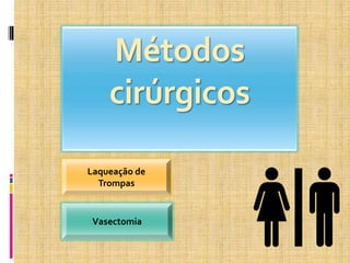 Métodos
cirúrgicos
Laqueação de
Trompas
Vasectomia
 