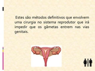 Estes são métodos definitivos que envolvem
uma cirurgia no sistema reprodutor que irá
impedir que os gâmetas entrem nas vias
genitais.
 