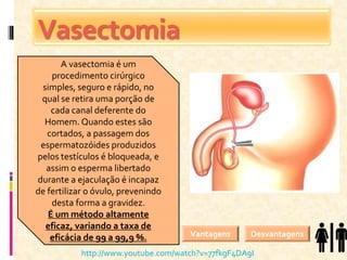 Vasectomia
A vasectomia é um
procedimento cirúrgico
simples, seguro e rápido, no
qual se retira uma porção de
cada canal deferente do
Homem. Quando estes são
cortados, a passagem dos
espermatozóides produzidos
pelos testículos é bloqueada, e
assim o esperma libertado
durante a ejaculação é incapaz
de fertilizar o óvulo, prevenindo
desta forma a gravidez.
É um método altamente
eficaz, variando a taxa de
eficácia de 99 a 99,9 %. Vantagens Desvantagens
http://www.youtube.com/watch?v=77fkgF4DA9I
 