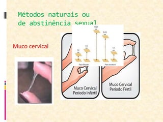 Métodos naturais ou
de abstinência sexual
Muco cervical
 