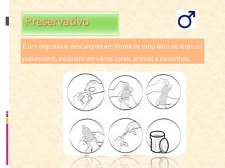 Preservativo
É um dispositivo descartável em forma de tubo feito de látex ou
poliuretano, existindo em várias cores, aromas e tamanhos.
 