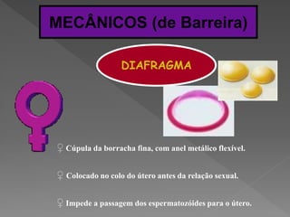 MECÂNICOS (de Barreira)

                  DIAFRAGMA




♀ Cúpula da borracha fina, com anel metálico flexível.

♀ Colocado no colo do útero antes da relação sexual.

♀ Impede a passagem dos espermatozóides para o útero.
 