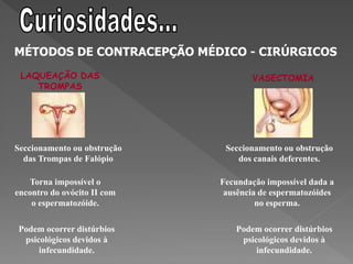 MÉTODOS DE CONTRACEPÇÃO MÉDICO - CIRÚRGICOS
 LAQUEAÇÃO DAS                      VASECTOMIA
    TROMPAS




Seccionamento ou obstrução    Seccionamento ou obstrução
  das Trompas de Falópio         dos canais deferentes.

    Torna impossível o       Fecundação impossível dada a
encontro do ovócito II com    ausência de espermatozóides
    o espermatozóide.                 no esperma.

Podem ocorrer distúrbios        Podem ocorrer distúrbios
 psicológicos devidos à          psicológicos devidos à
     infecundidade.                  infecundidade.
 