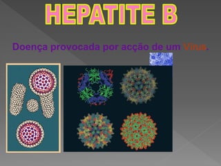 Doença provocada por acção de um Vírus.
 