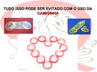 TUDO ISSO PODE SER EVITADO COM O USO DATUDO ISSO PODE SER EVITADO COM O USO DA
CAMISINHACAMISINHA
 